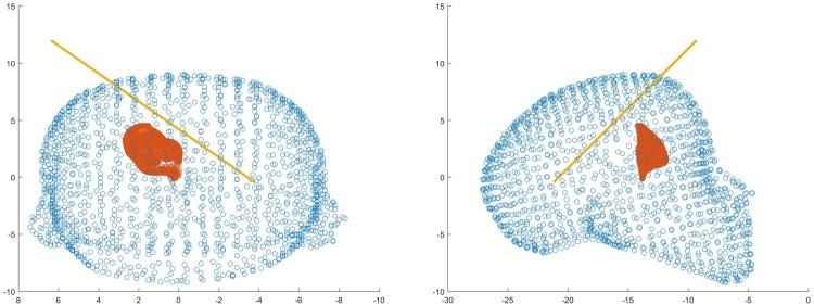 Fig. 13