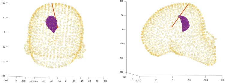 Fig. 10