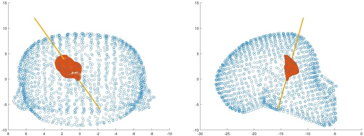 Fig. 14