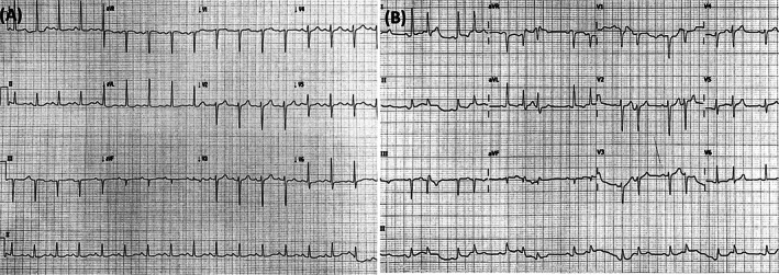 FIGURE 3