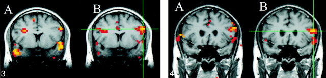 fig 2.