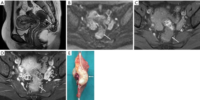 Figure 14