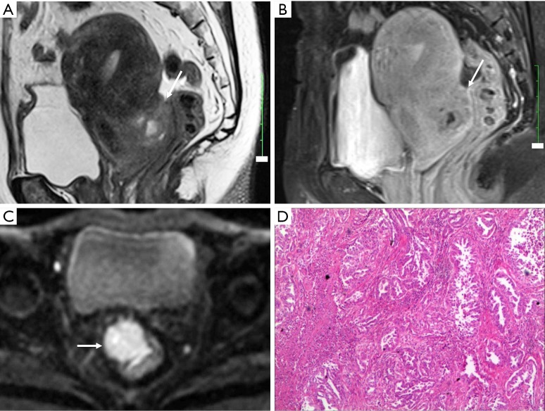 Figure 16