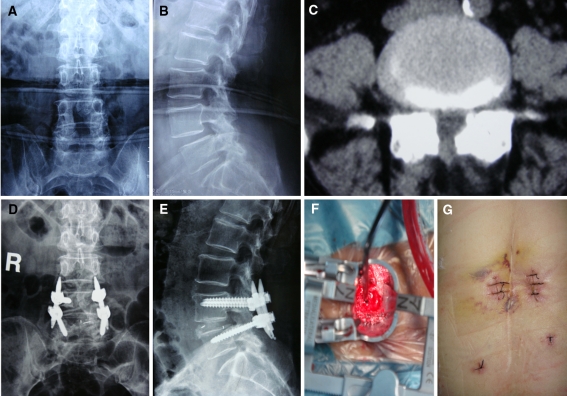 Fig. 1