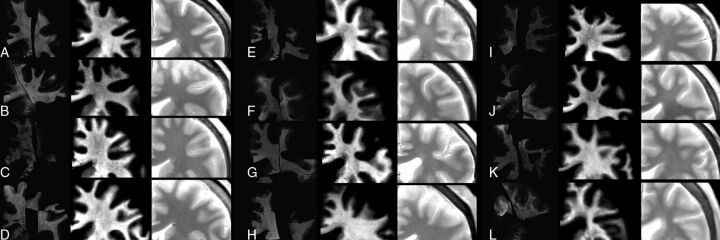 Fig 3.