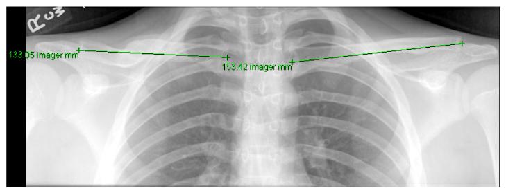 Figure 6-B