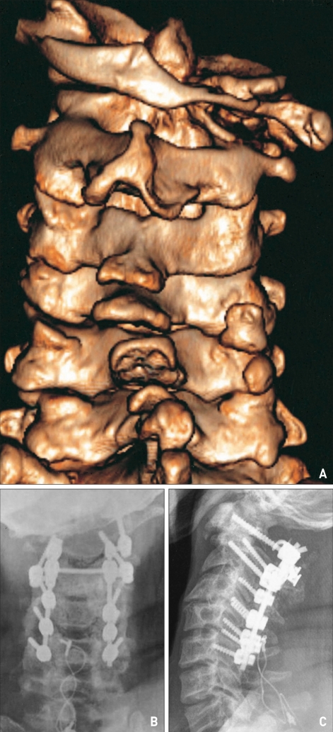 Fig. 4