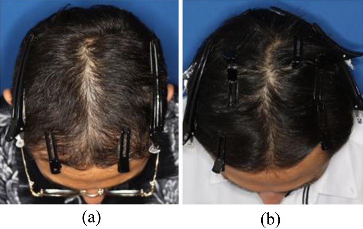 Fig. (5)