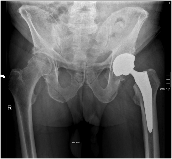 Figure 2
