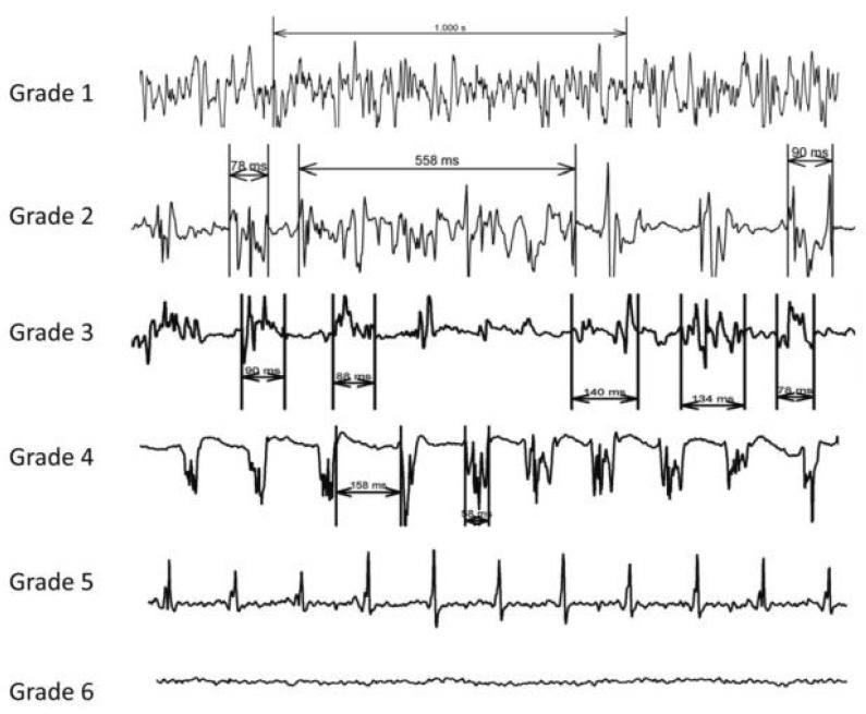 Fig. (5)