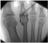 Fig. 5