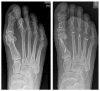 Fig. 13