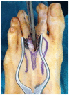 Fig. 14