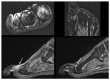 Fig. 11
