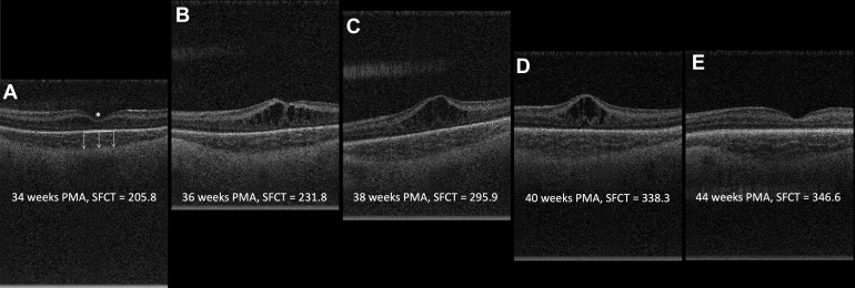 Figure 2