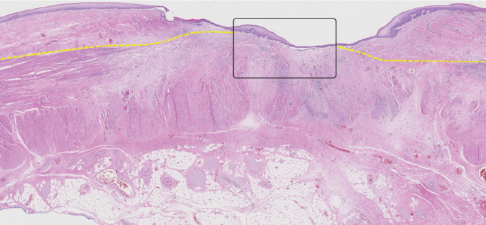 BJS-11760-FIG-0005-c