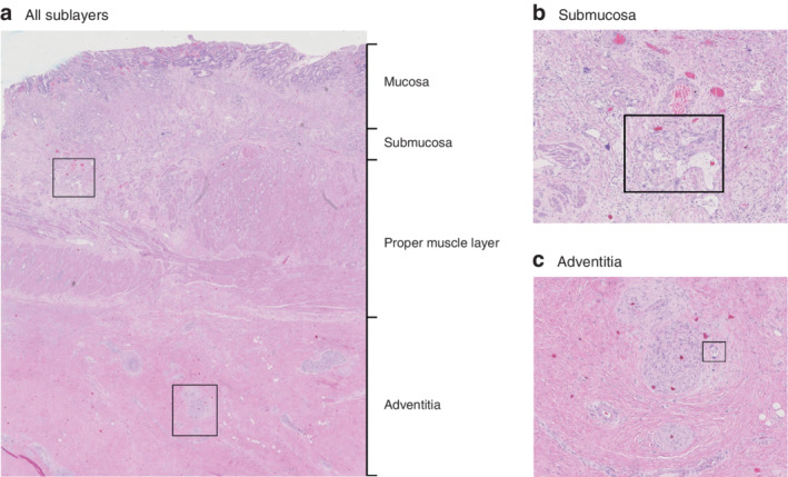 BJS-11760-FIG-0001-c