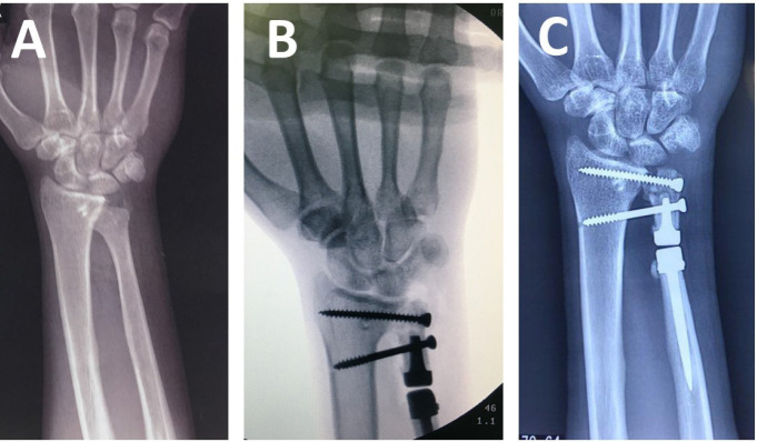 Figure 3A-C