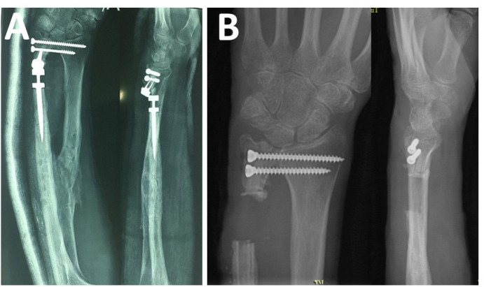 Figure 4A-B