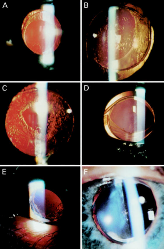 Figure 1  