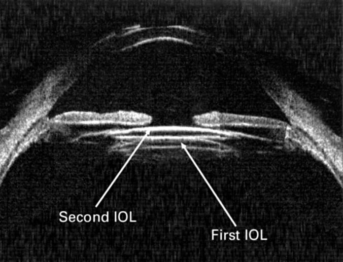 Figure 2  