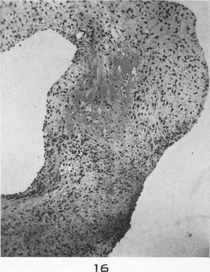 Fig. 16