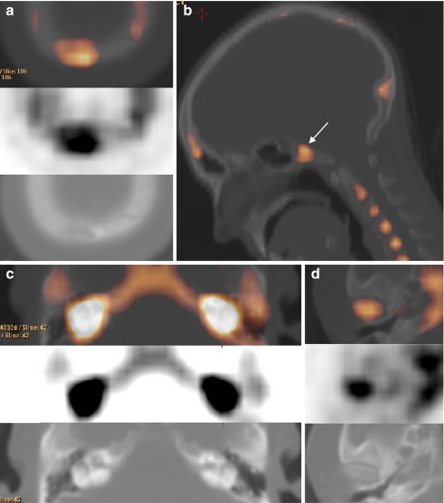 Fig. 4