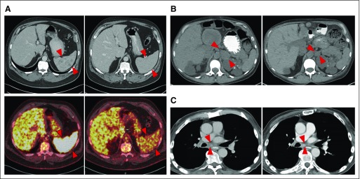 Fig 3.