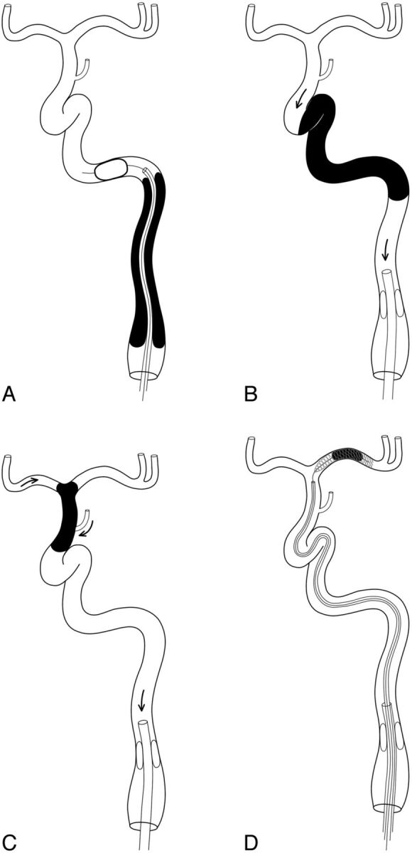 Fig 2.