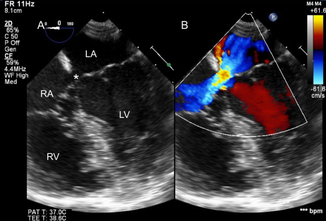 Figure 25