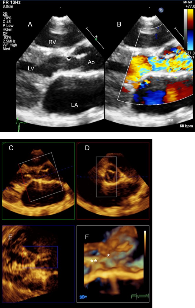 Figure 23