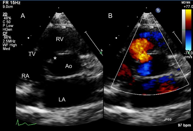 Figure 14