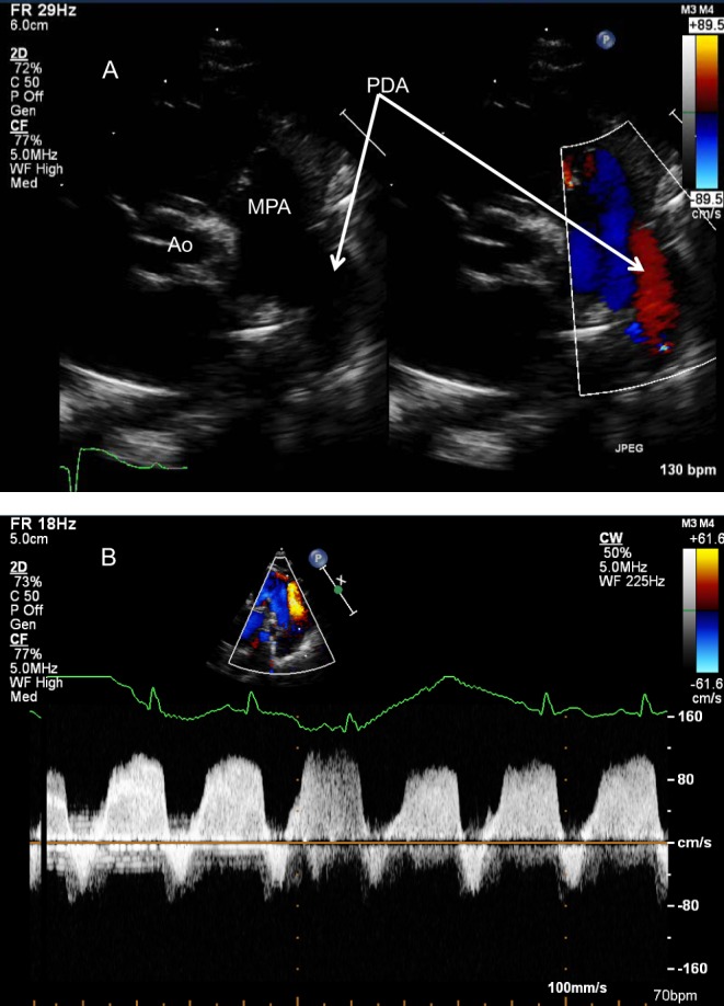 Figure 26