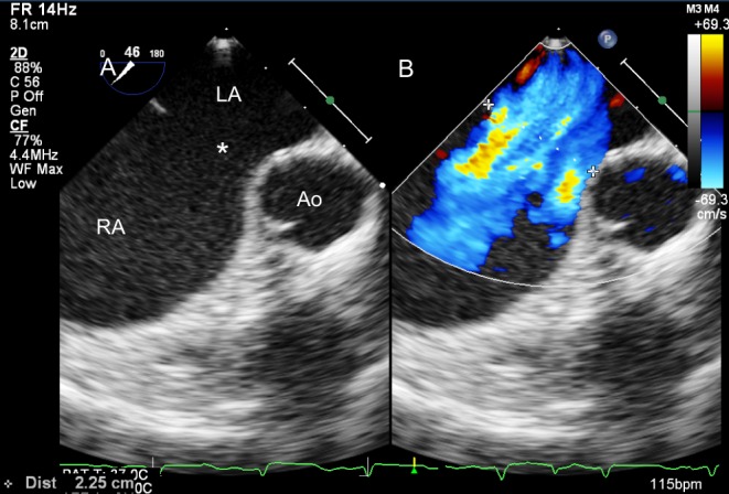 Figure 9