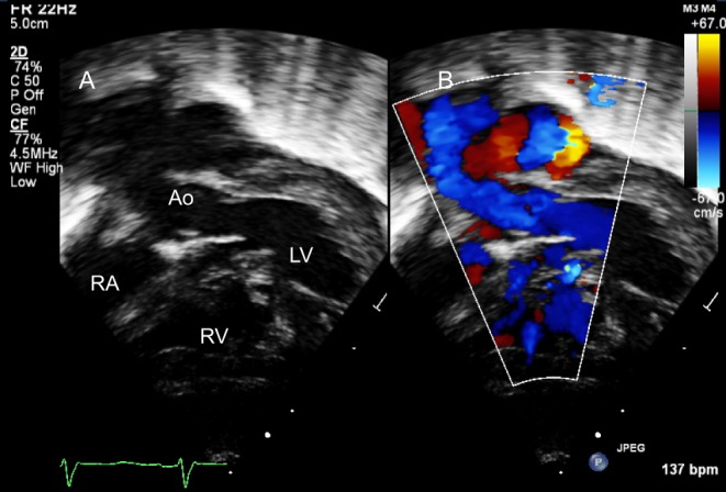 Figure 21