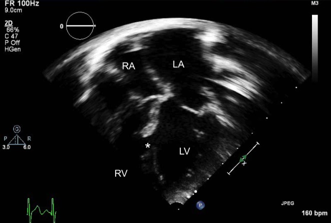 Figure 16