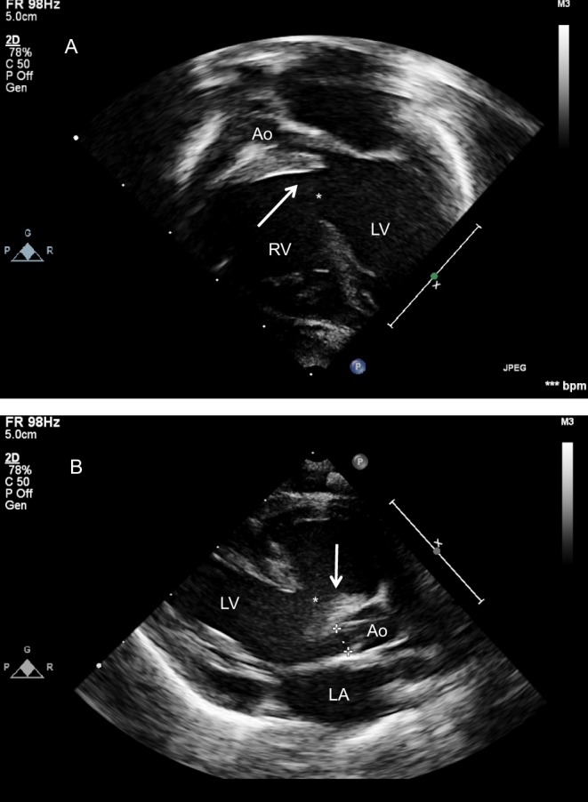 Figure 18