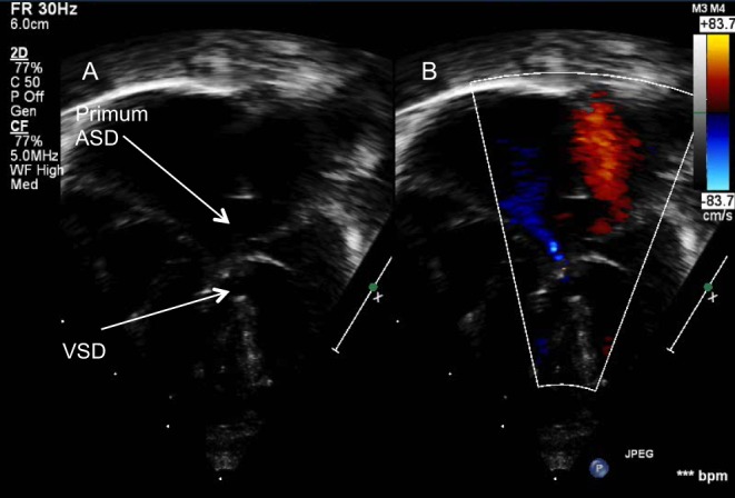 Figure 22