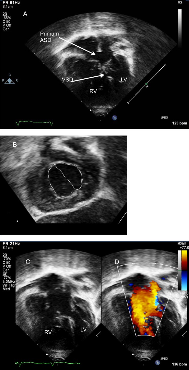 Figure 24