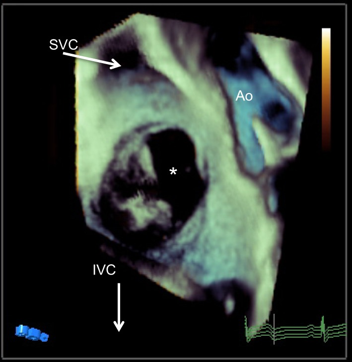 Figure 12