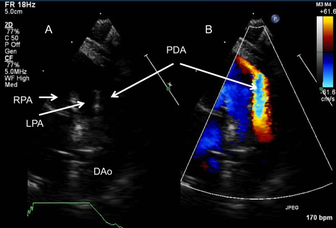 Figure 27