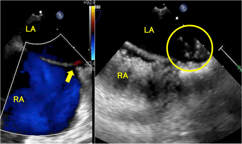 Fig. 2