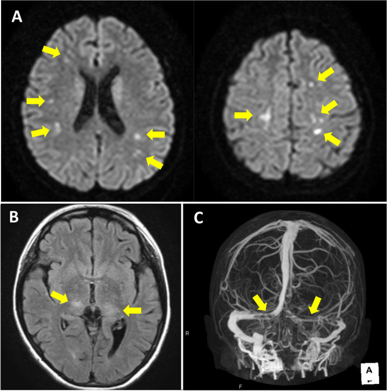 Fig. 1