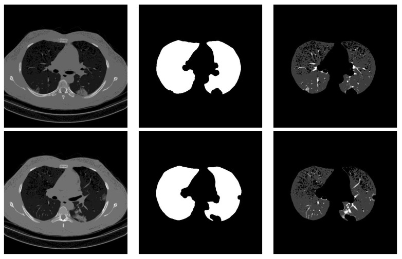 Figure 12