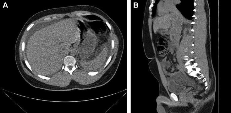 Fig. 1