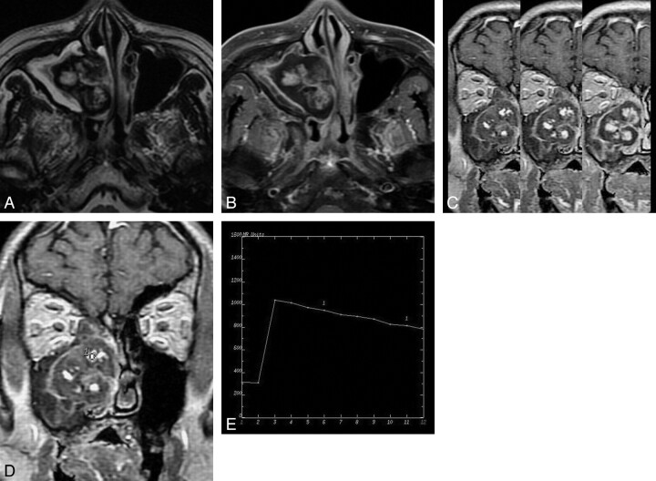 Fig 4.