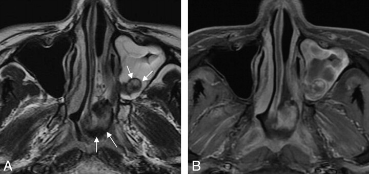 Fig 2.