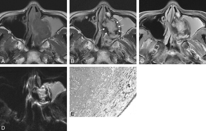 Fig 1.