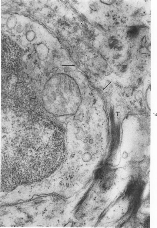 Fig. 14