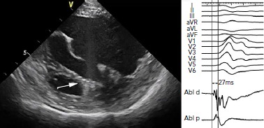 Figure 3: